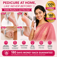 Load image into Gallery viewer, 🔥🛍️ Top-Rated Pedicure Tool Rechargeable ✨ with a 180-Day Money Back Guarantee! 💖✨