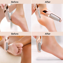 Load image into Gallery viewer, 🔥🛍️ Top-Rated Pedicure Tool Rechargeable ✨ with a 180-Day Money Back Guarantee! 💖✨